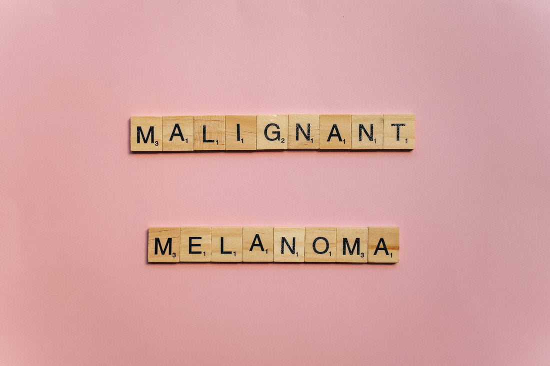 How to Prevent Melanoma